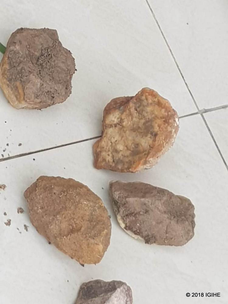 Aya ni amwe mu mabuye yatewe ku nzu ya Bashunga