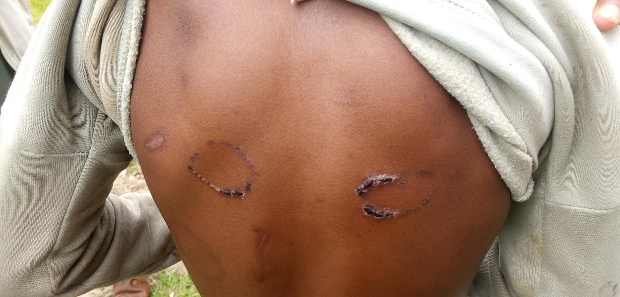 Umugore uherutse gufungirwa kuruma umwana we, yongeye kumuruma aramukomeretsa