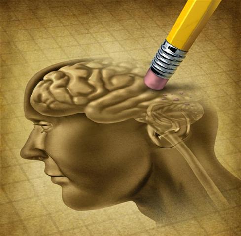 Alzheimer, ni indwara itera kwibagirwa ubusanzwe imenyerewe ku bantu bashaje