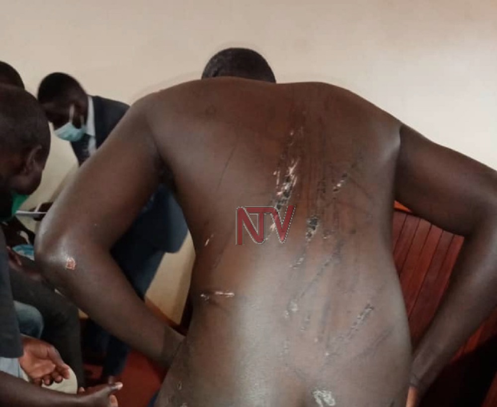 Bamwe imigongo yabaye ibisebe kubera inkoni