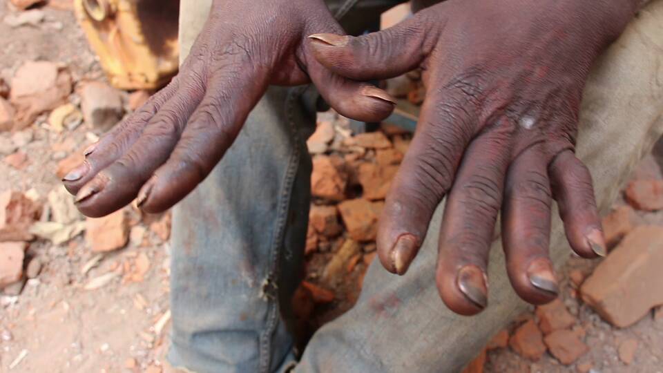 Isuku nke ku mubiri we ishobora kumuteza izindi ndwara