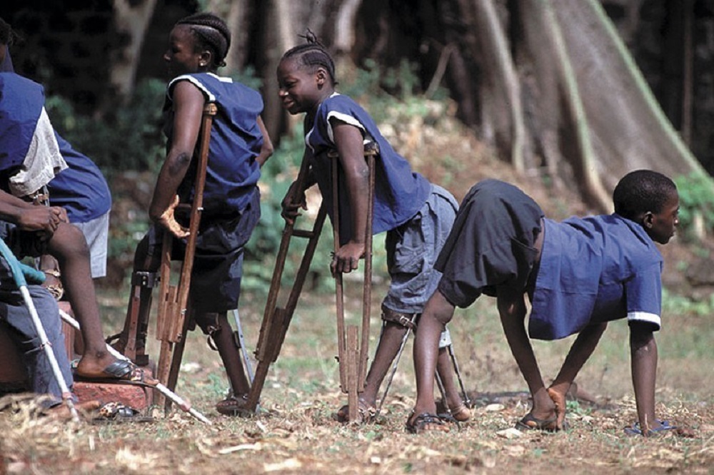Indwara y'imbasa ishobora gutere ubumuga butandukanye iyo itavuwe neza