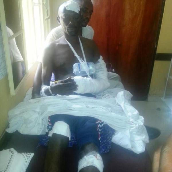 Mutaguma watemwe n'abagizi ba nabi arwariye mu bitaro bya CHUK