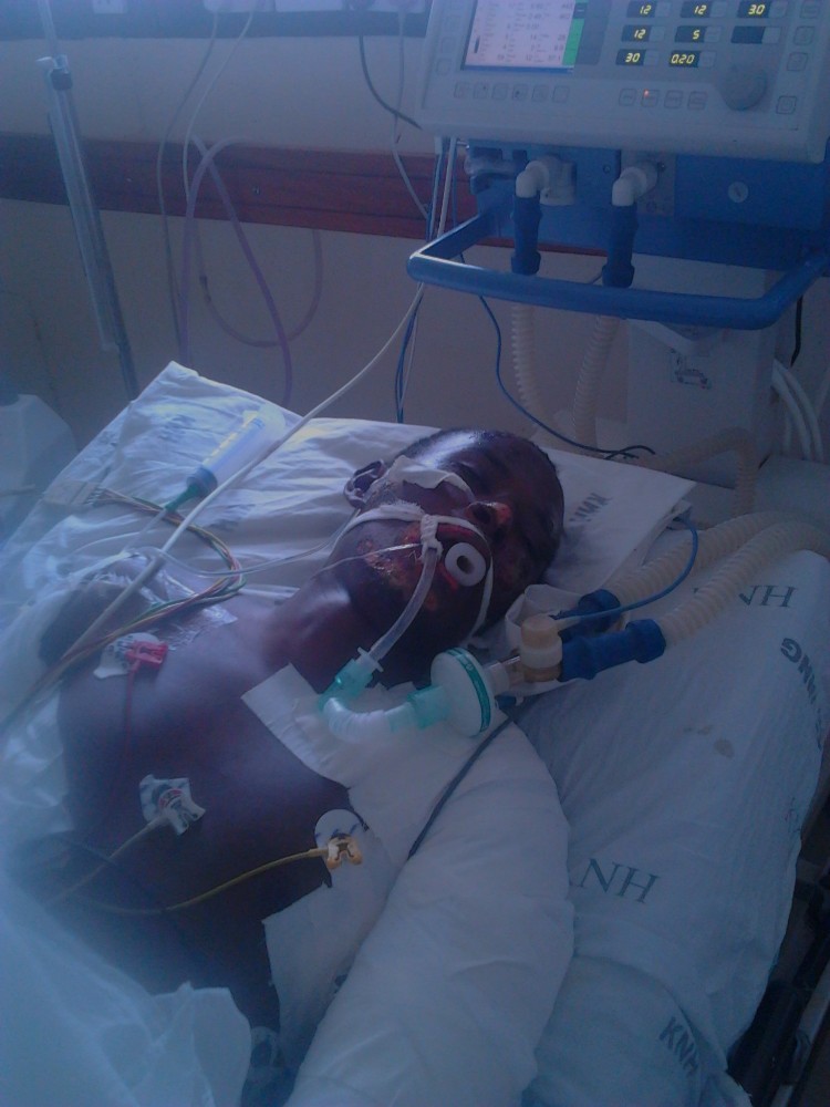 Sibomana Jean Damascène mu gihe yitabwagaho n'abaganga akimara gukora impanuka