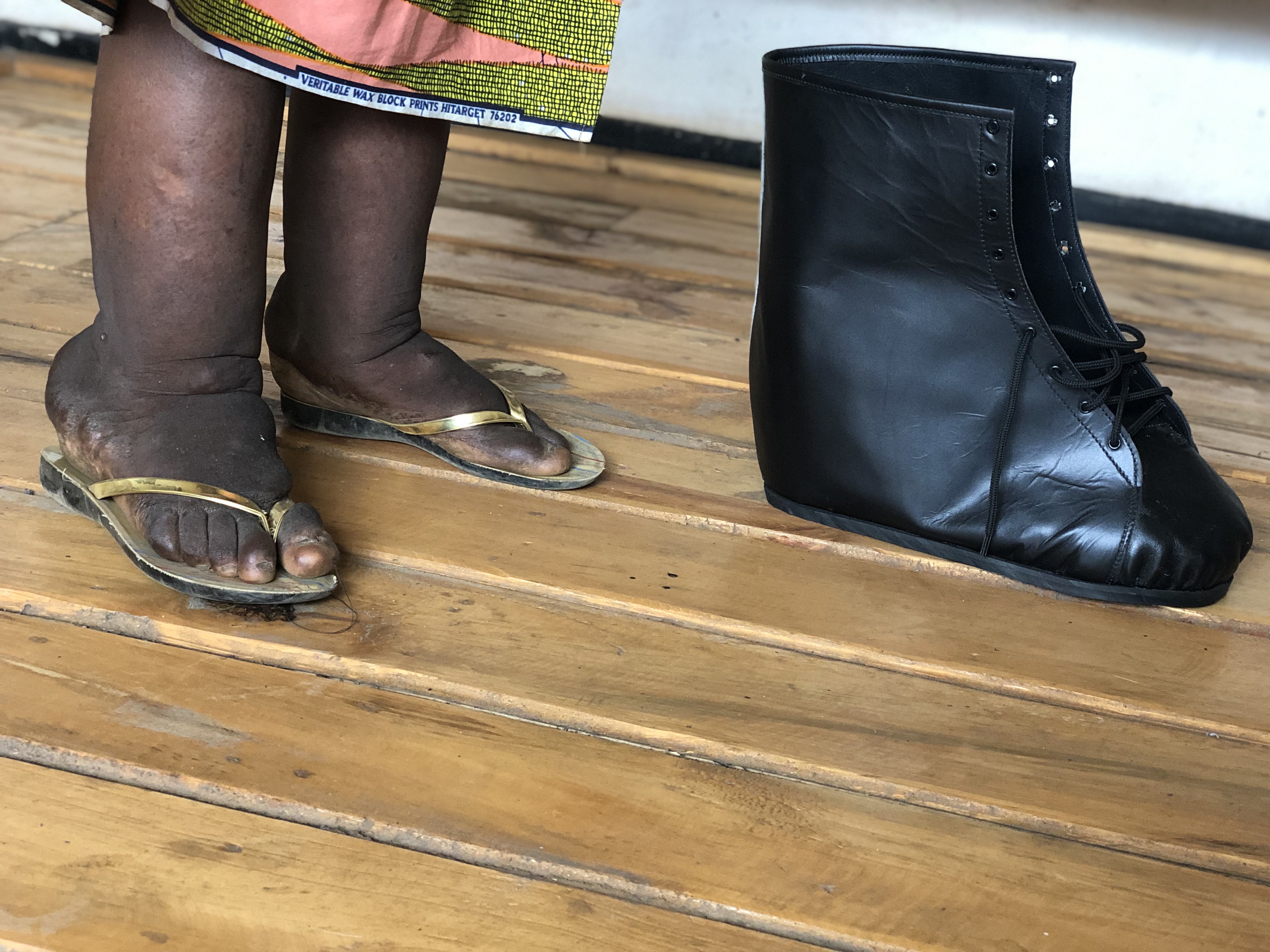 Iby’ingenzi ku ndwara y’imidido bamwe bitiranya n’amarozi
