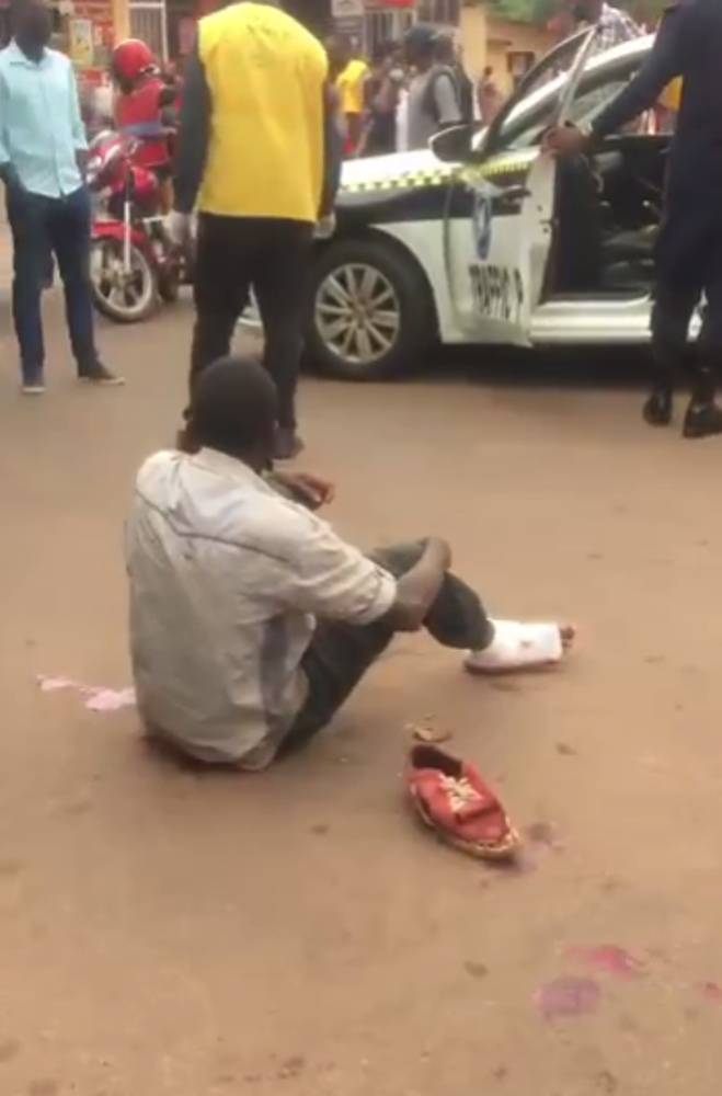 Uwagonzwe yakomeretse ukuguru ndetse yajyanywe kwa muganga